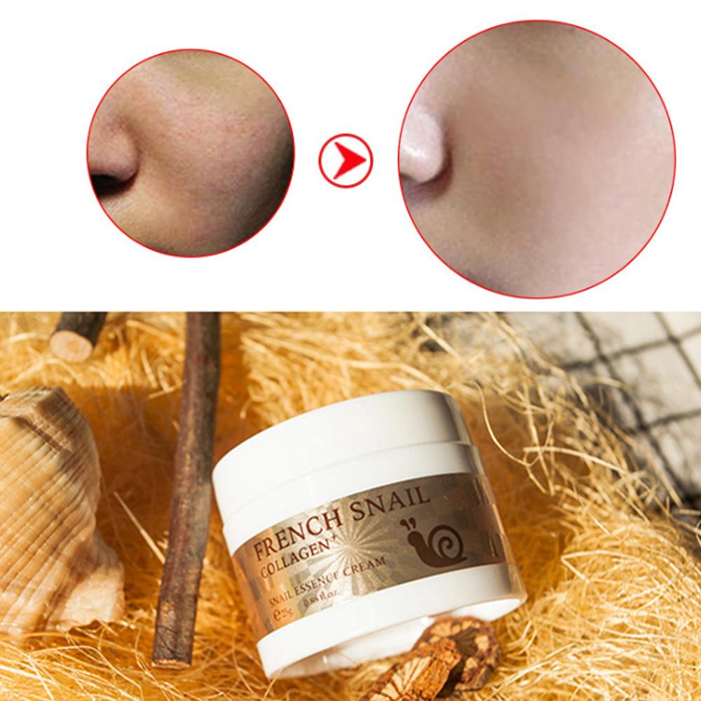 [Hàng mới về] Kem dưỡng da mắt chiết xuất ốc sên chất lượng cao
