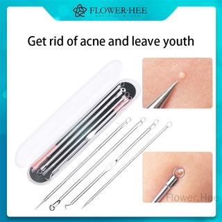 (Hàng Mới Về) Set 4 Dụng Cụ Nặn Mụn Đầu Đen Bằng Thép Không Gỉ Cao Cấp