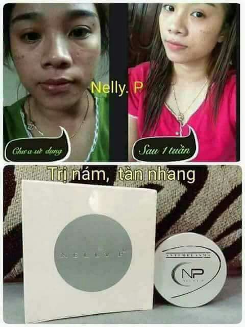 Kem trị Nám tàn nhang trứng cá hồi Nelly.p