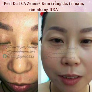 Kem Dưỡng Da Hàn Quốc DR.V
