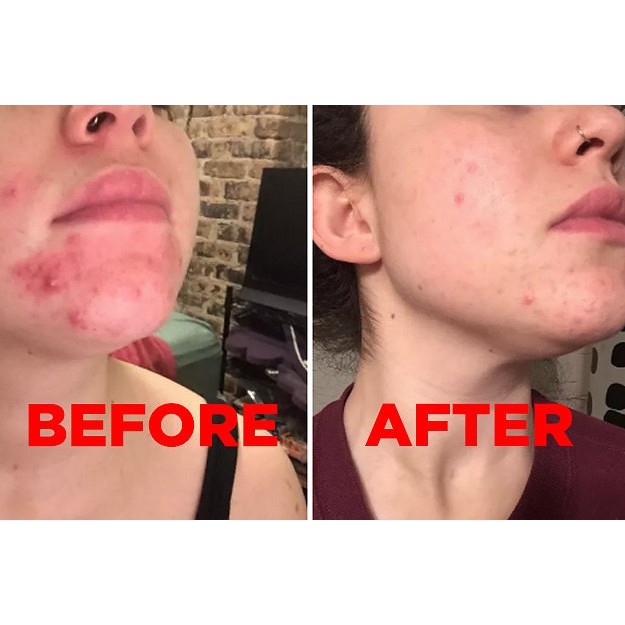 BỘT MẶT NẠ ĐẤT SÉT AZTEC SECRET INDIAN HEALING CLAY