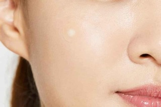 🍀MIẾNG DÁN MỤN CIRACLE RED SPOT ACNE PIMPLE PATCH