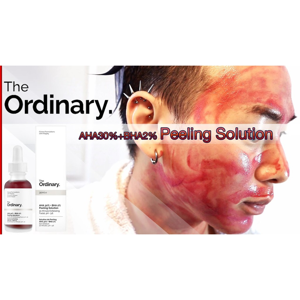 (Sẵn - Auth) The Ordinary AHA 30% + BHA 2% Peeling Solution (Tẩy da chết hoá học)