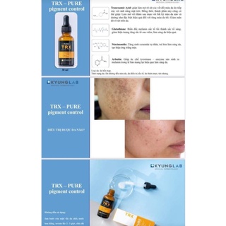 (Công ty) Tinh chất sáng da mờ nám sạm trx kyunglab