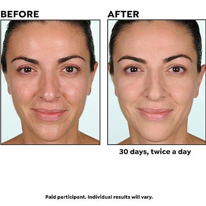 Serum tinh chất trẻ hóa da Lancome Advanced Genifique Youth Activating Concentrate