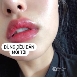 Nạ Môi Vaselinee 4,9gr.