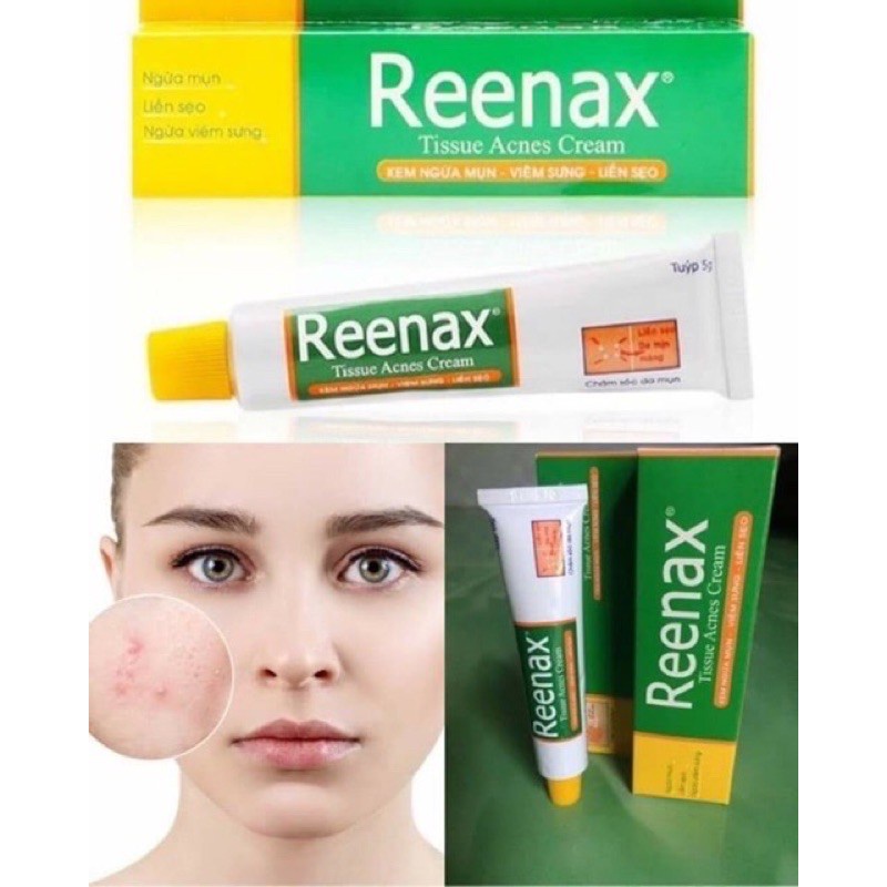 Reenax kem ngừa mụn viêm sưng liền sẹo
