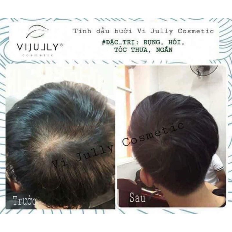 Chính Hãng Xịt Tinh Dầu Bưởi Vịully Natural Ngăn Rụng, Kích Mọc,Phục Hồi hư Tổn. ( tặng quà xinh) | BigBuy360 - bigbuy360.vn
