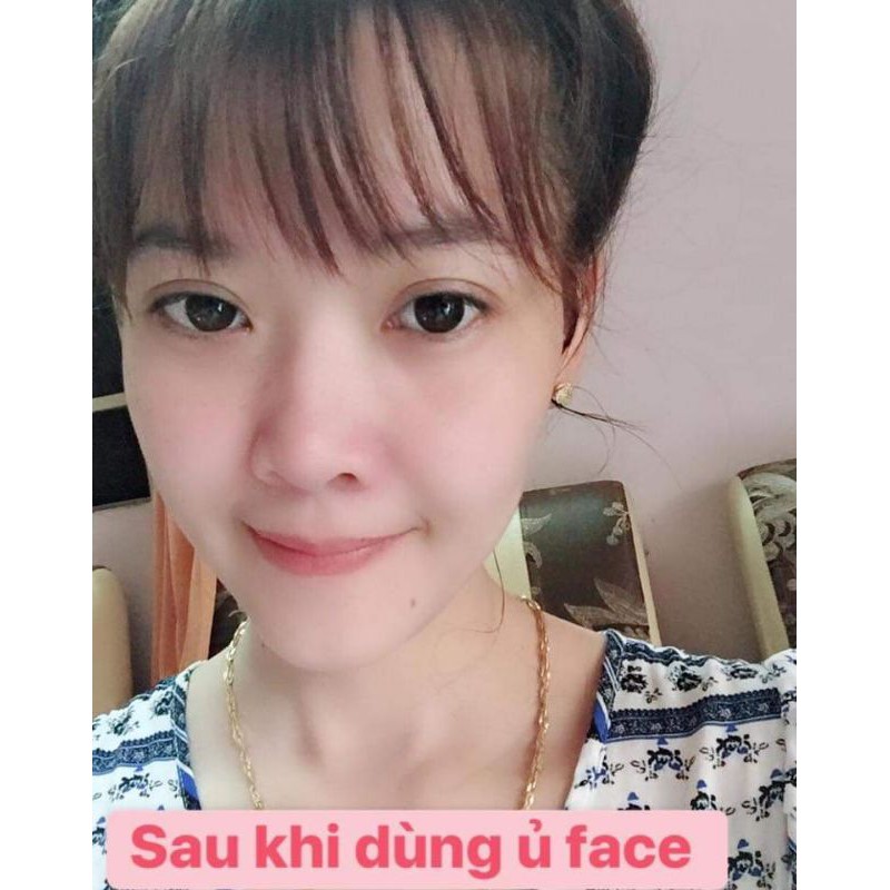 Ủ Tắm Trắng Mặt Vip Erina | BigBuy360 - bigbuy360.vn