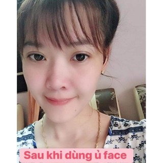Ủ Tắm Trắng Mặt Vip Erina