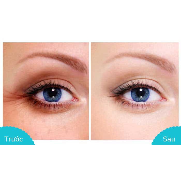 Tuyp Lăn Tinh Chất Nha Đam Giảm Thâm Quầng Mắt FarmStay Aloe 30ml | BigBuy360 - bigbuy360.vn