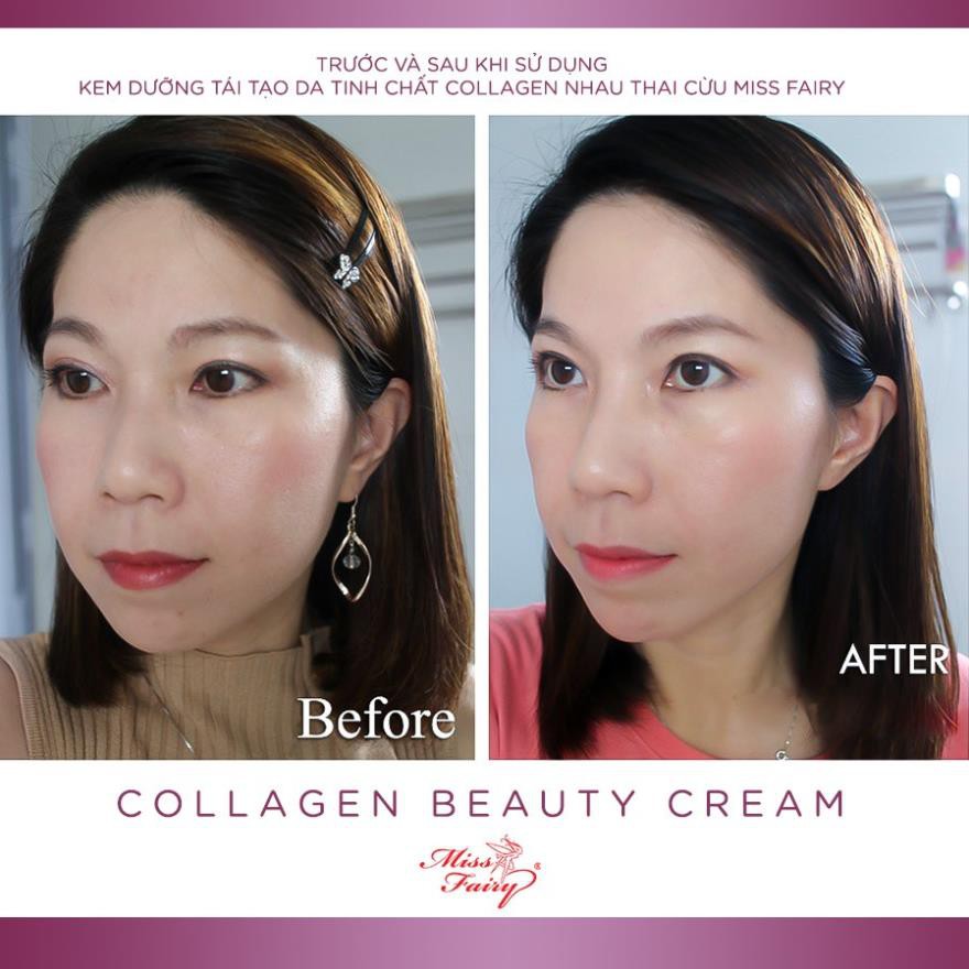 Kem Dưỡng Da Ngừa Lão Hoá Collagen Miss Fairy