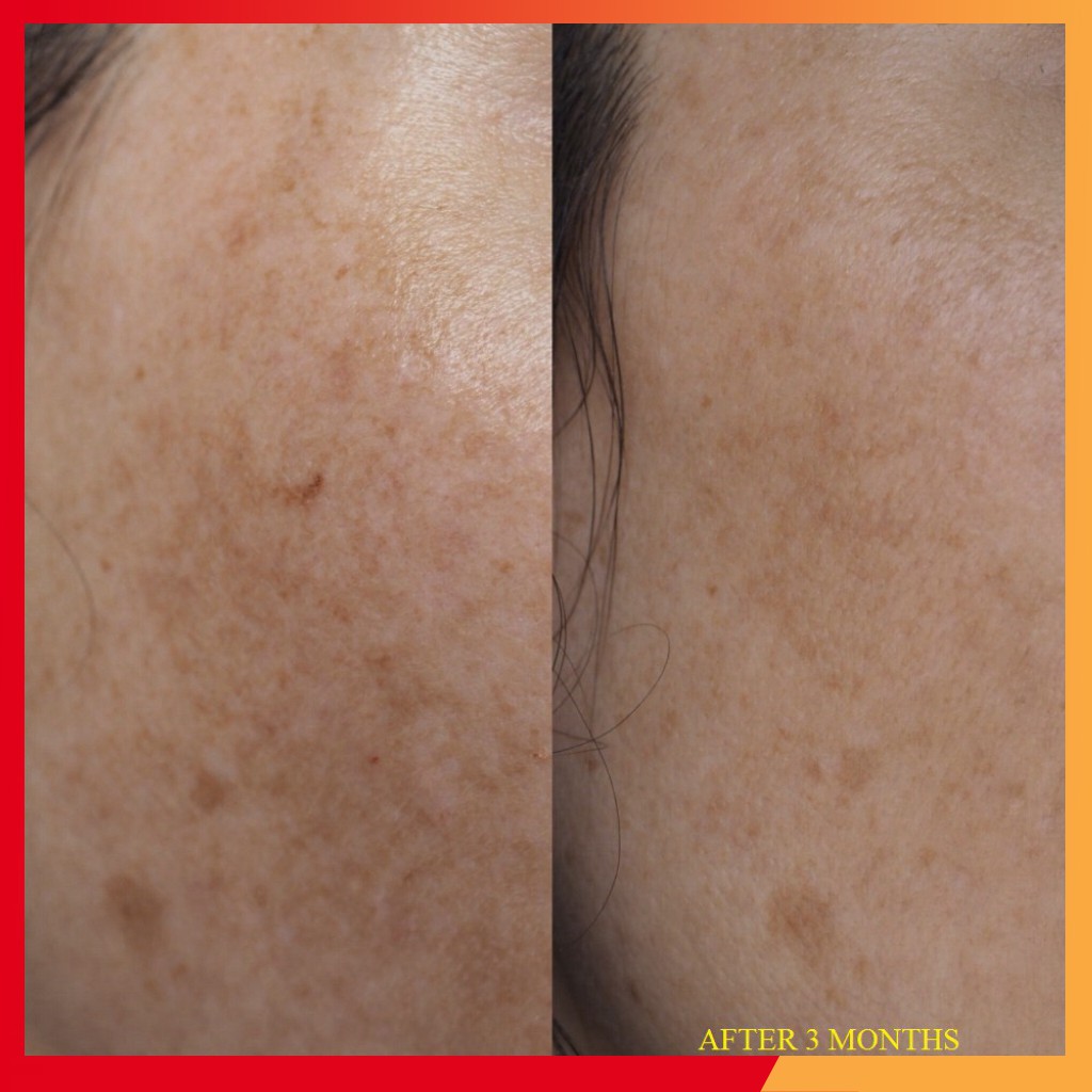 chính hãng Serum mờ nám tàn nhang NIOD RE: Pigment