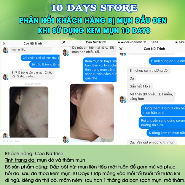 2 lọ kem mụn thảo dược 10  Days chính hãng, sạch mụn ẩn, đầu đen dưỡng da trắng hồng