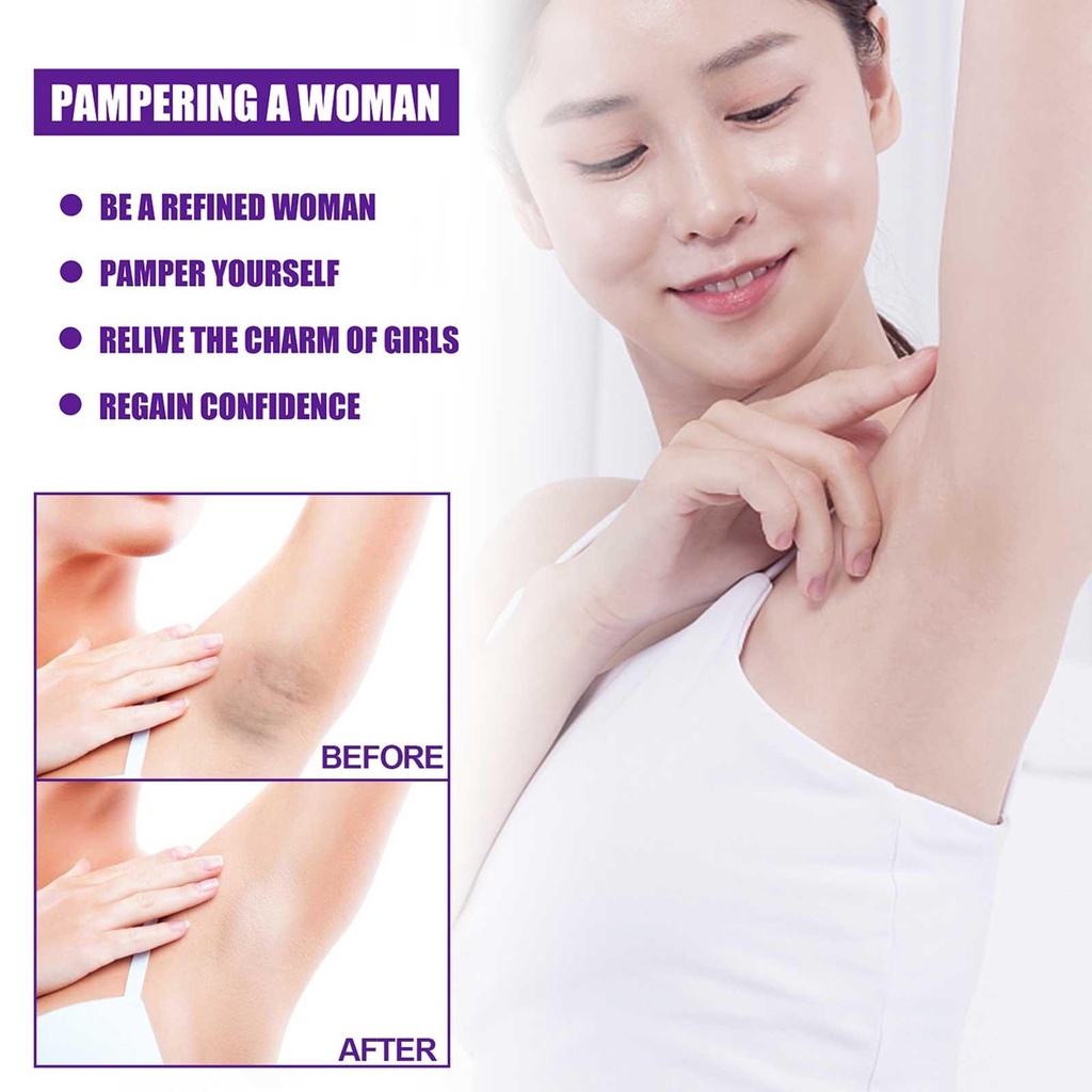 Kem Tẩy Trắng Vùng Da Dưới Cánh Tay / Đầu Gối / Môi / Toàn Thân S3Z8