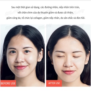 Tinh chất chống lão hóa The Ordinary Argireline Solution 10% 30ml