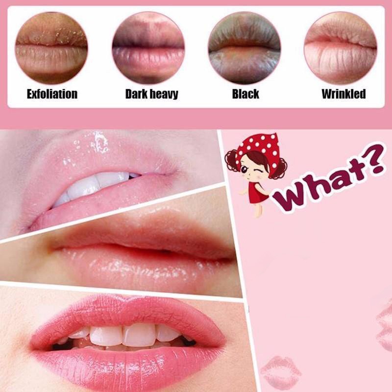 Miếng ủ mặt nạ môi Collagen Cherry Rorec dưỡng ẩm làm mềm dưỡng hồng mờ thâm môi mỹ phẩm nội địa Trung