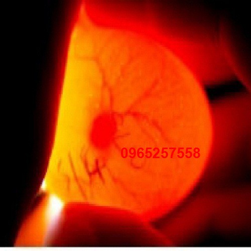 Máy Ấp Trứng Ánh Dương P100 -Tặng vitamin úm cao cấp