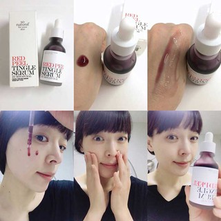 Tẩy Da Chết Hóa Học So'Natural Red Peel Tingle Serum hỗ trợ mờ thâm se lỗ chân lông