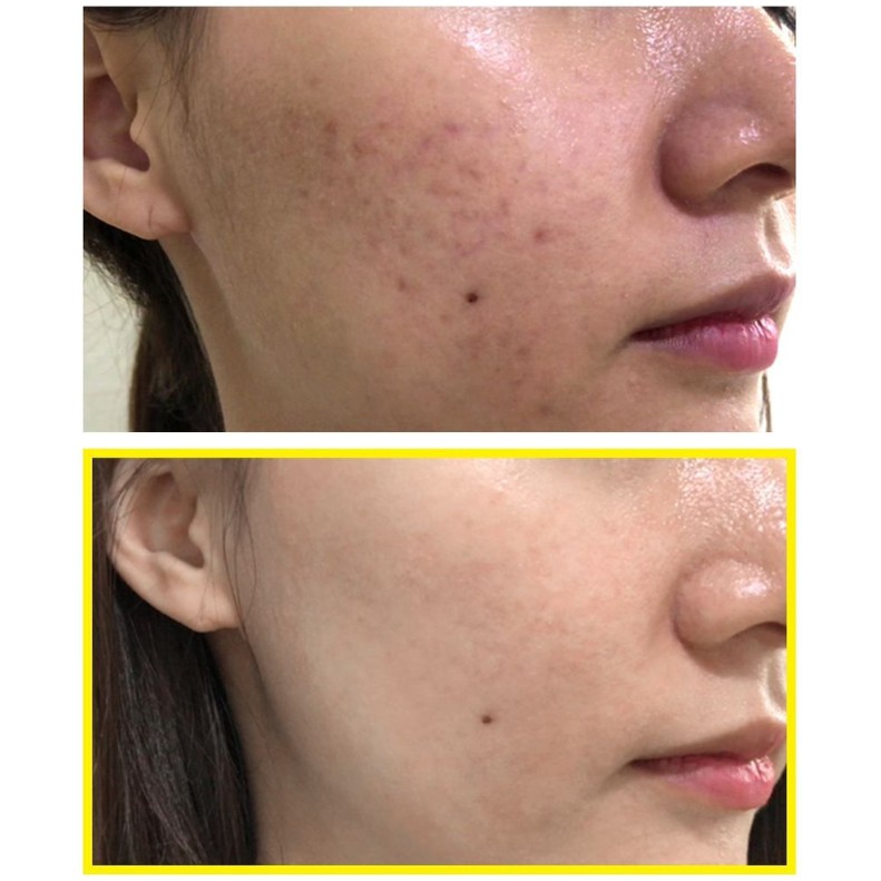 Some By Mi / Tinh Chất Dưỡng Trắng Da Some By Me Yuja Niacin 30 Days Blemish Care Serum