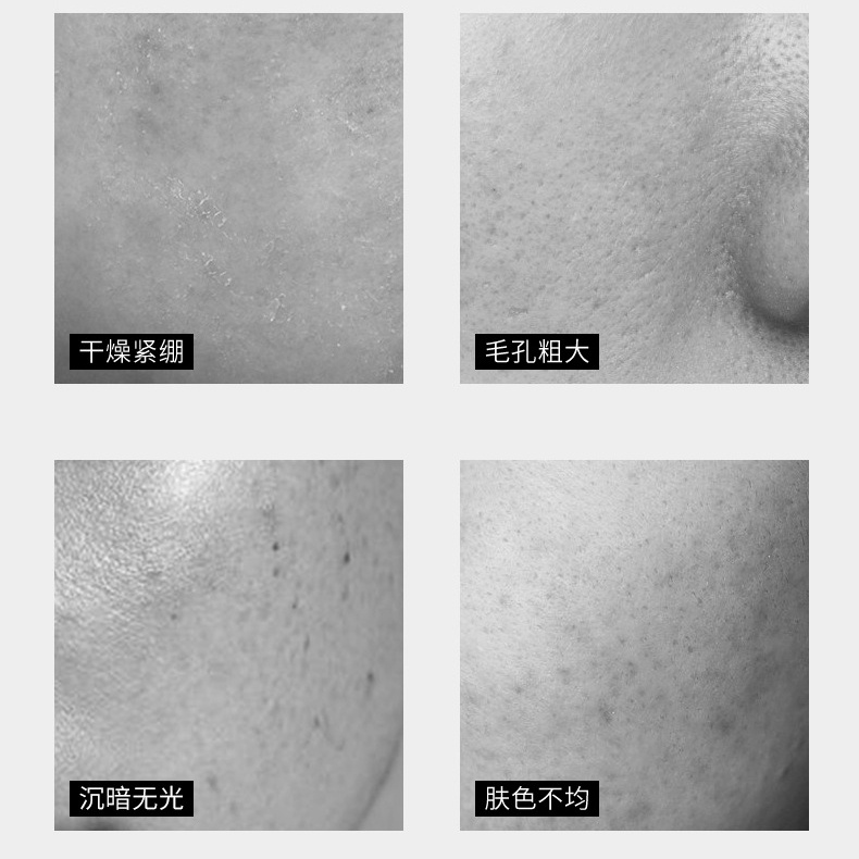 Sữa Rửa Mặt Tạo Bọt Công Thức Hàn Quốc 5 Công Thức Phổ Biến Làm Sạch Da Mặt Trắng Trong Suốt Dưỡng Ẩm