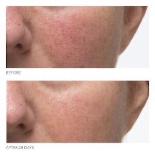 Serum Dr Dennis Gross Ferulic Acid Retinol Brightening Solution