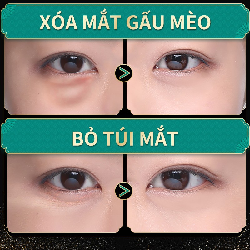 Kem Dưỡng Da Mắt SOON PURE 15g Giữ Ẩm Chống Lão Hóa Và Nếp Nhăn | BigBuy360 - bigbuy360.vn