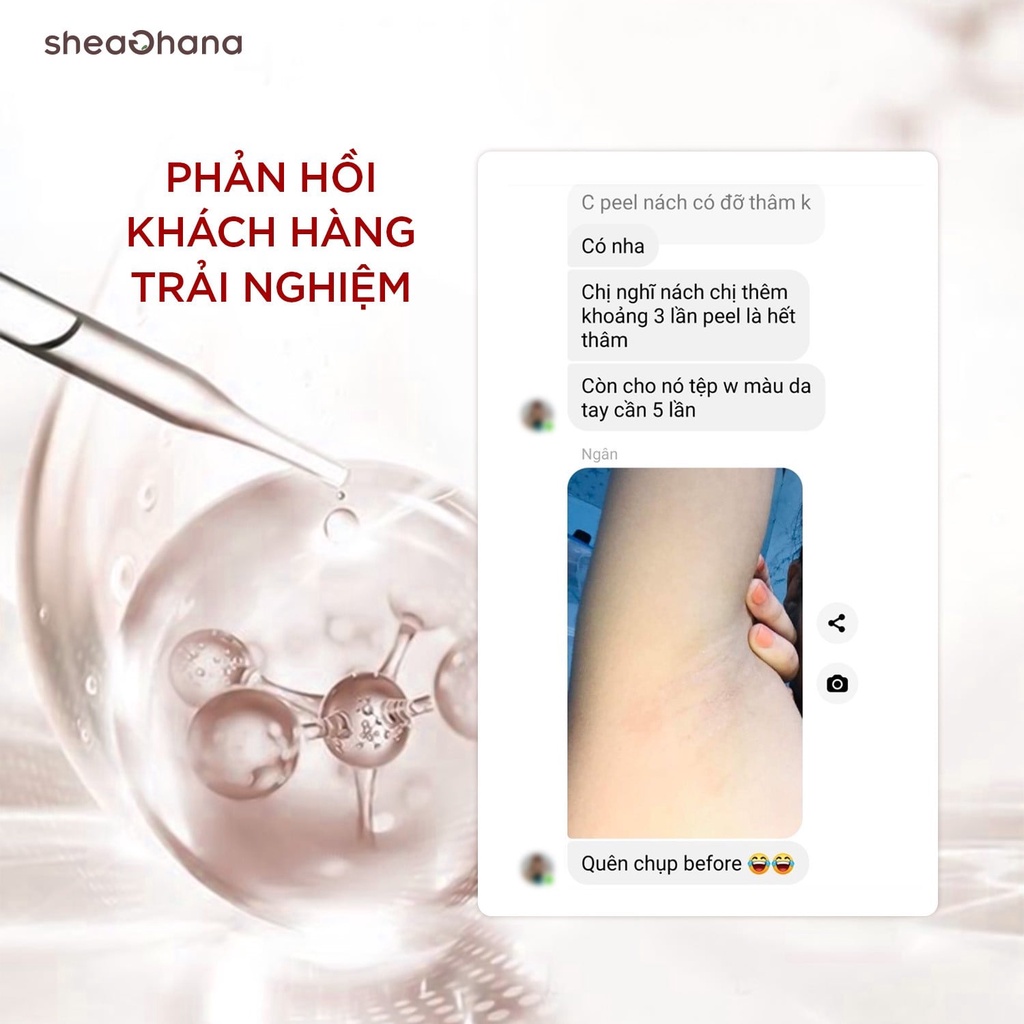 Dung dịch peel da hỗ trợ giảm nám 30% Mandelic Acid