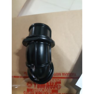 Cổ lọc gió (Cổ bô e) Sirius - Jupiter