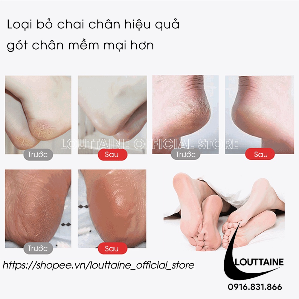 Cây bào nạo gót chân giá rẻ, Dụng cụ chà gót chân và vết chai sần 2in1 kèm 20 lưỡi cạo tiện lợi