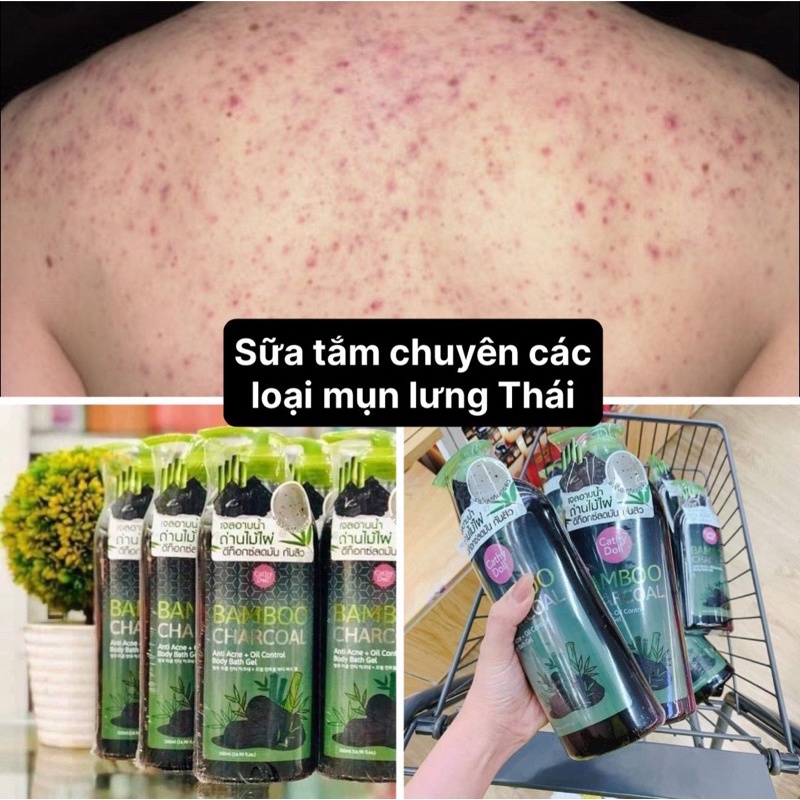SỮA TẮM MỤN LƯNG , SỮA TẮM THAN TRE CATHY DOLL 500ML THÁI LAN