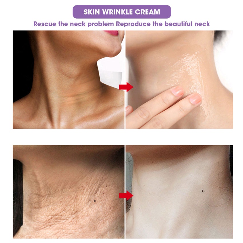 Kem Collagen Làm Trắng Da Mặt Chống Nếp Nhăn Và Làm Săn Chắc Da