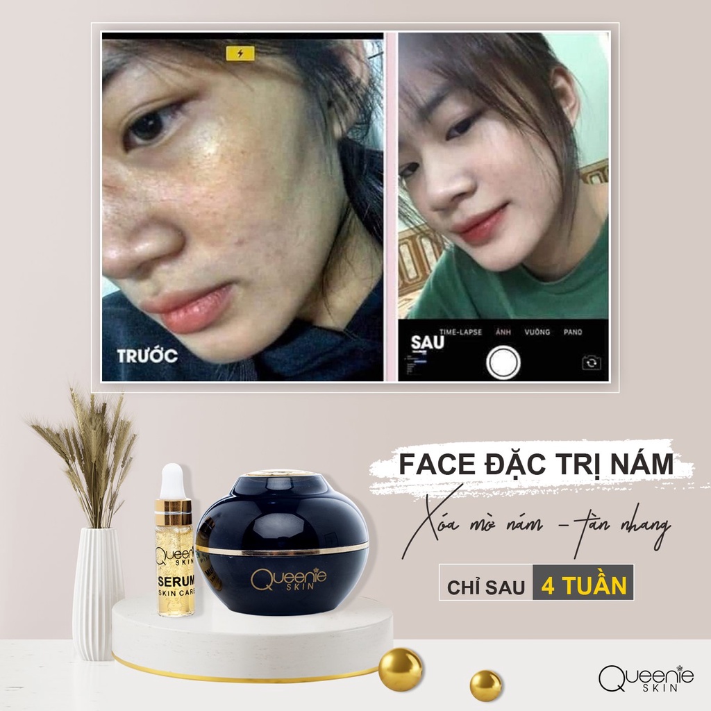 [FreeShip + Tặng Viên Uống &amp; Huyết Thanh Trắng Da] Kem Nám Queenie Skin Chính Hãng - Kem Ngừa Nám Queenie Skin Date 2024