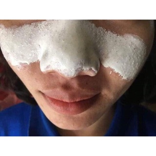 Gel lột mụn Huyền Phi 120k