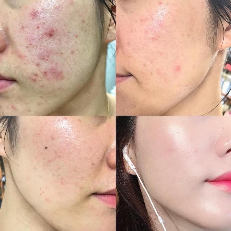 Kem Dưỡng Làm Dịu, Phục Hồi Da Chiết Xuất Rau Má Skin1004 Madagascar Centella Cream 75ml