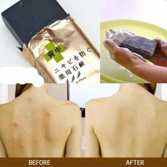 Xà Bông Cục Giảm Mụn Body Chỉ Sau 14 Ngày - Xà Phòng Mụn Lưng For Back Pelican Nhật 135gr