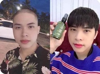 COMBO 3 CHAI TINH DẦU BƯỞI KÍCH MỌC TÓC ( tặng quà hấp dẫn )