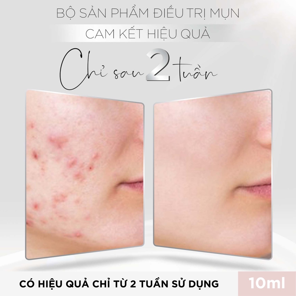 Kem mụn Lori B 10ml