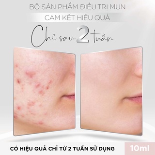 Kem mụn LoriB 10ml