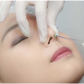 Dịch vụ nâng mũi bằng chỉ tại Gangwhoo