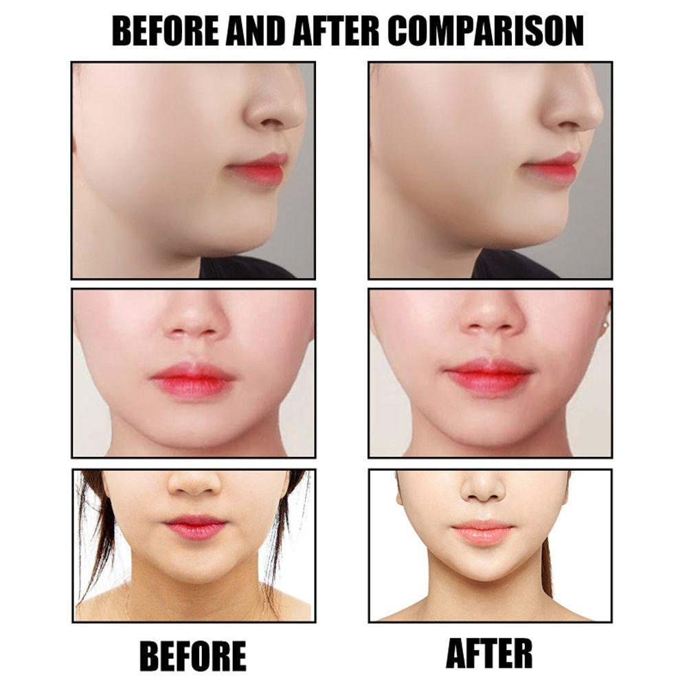 Hộp 40 Miếng Dán Nâng Cơ Mặt Tạo Cằm Chữ V Chống Lão Hóa