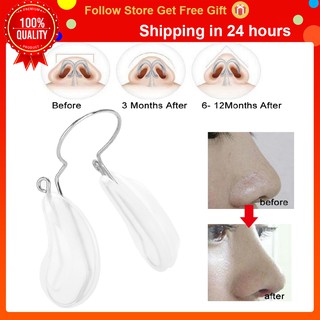 [Forest]Kẹp nâng và định hình mũi