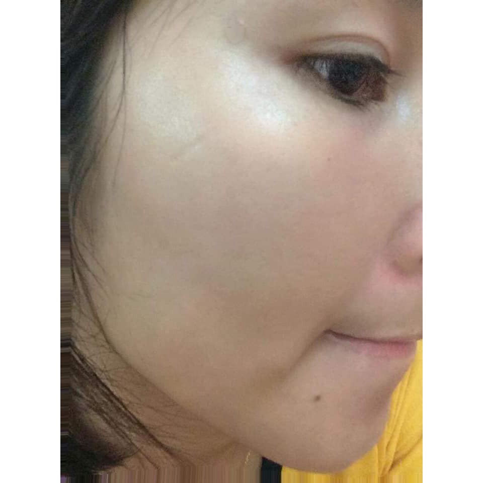 CAO NÁM MAGIC SKIN cao nám Royal Melasma Plus 👍  ngừa nám tàn nhang ✔ Size 13g