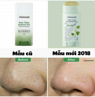 Thanh lăn mụn đầu đen Mamonde