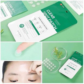 Miếng Dán Mụn Some By Mi Clear Spot Patch