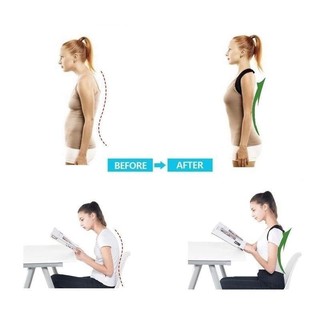 Đai Chống Gù Lưng Nhật Bản Dành Cho Mọi Lứa Tuổi