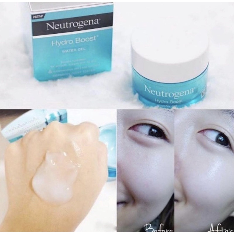 Kem dưỡng ẩm Neutrogena Hydro Boost Water Gel