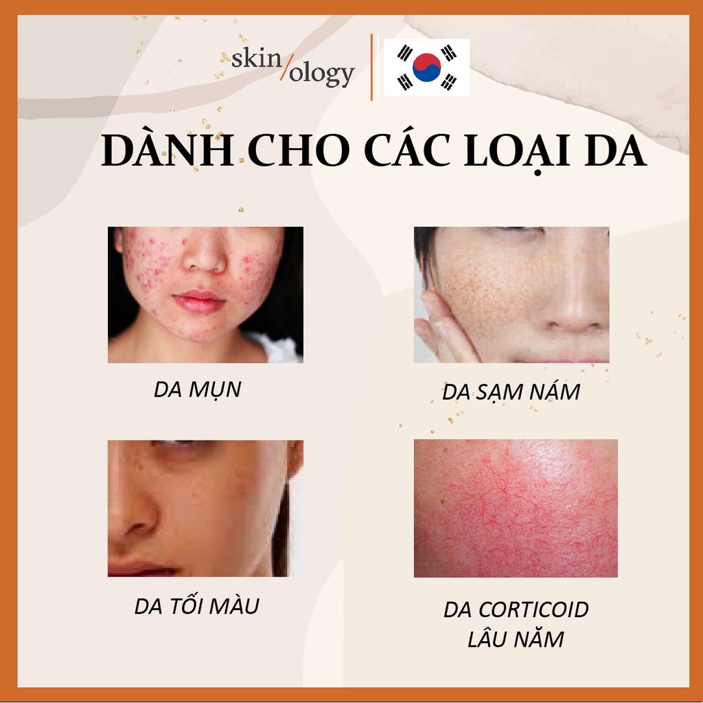 SERUM HỖ TRỢ TRỊ MỤN MỜ SẠM NÁM SE KHÍT LỖ CHÂN LÔNG TÁI TẠO TRẮNG DA SKIN RENEWAL SOLUTION SKINOLOGY CHO DA NHẠY CẢM