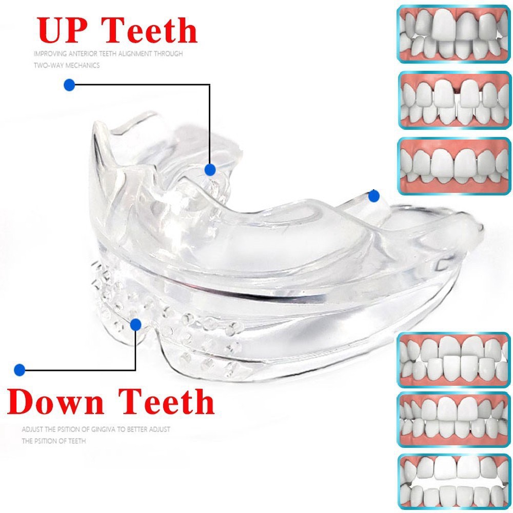 [HOT]  - Lẻ hàm A2 - Bộ Dụng Cụ Niềng Răng Tại Nhà - Niềng răng trong suốt ( 3 giai đoạn ) HÀNG CHUẨN