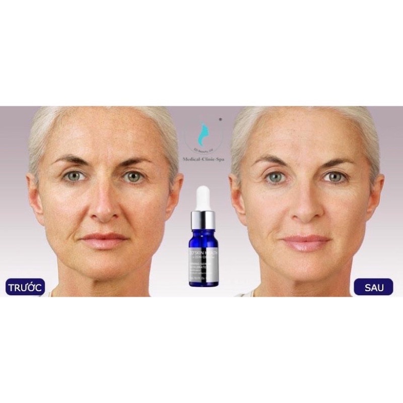 Serum trẻ hóa da ZO Skin Health Firming Serum Accelerated 6 lọ x 8ml